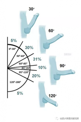 为什么有的人阴茎朝上的简单介绍