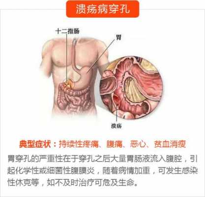 取卵后胃疼属于正常情况吗 取卵后为什么会胃痛