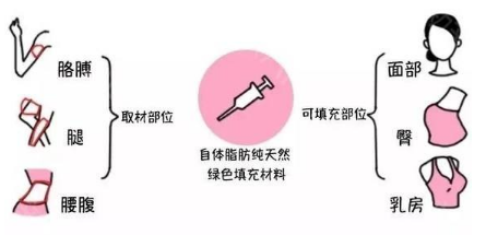 自体脂肪为什么要加prp_自体脂肪填充prf是什么意思