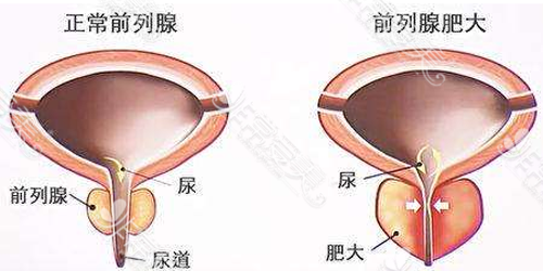  为什么找不到前列腺「找不到前列腺哪里错了」