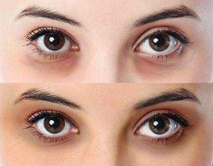 为什么眼睛常有黑眼圈_为什么眼睛常有黑眼圈呢