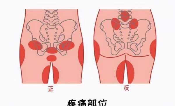 怀孕35周为什么耻骨痛