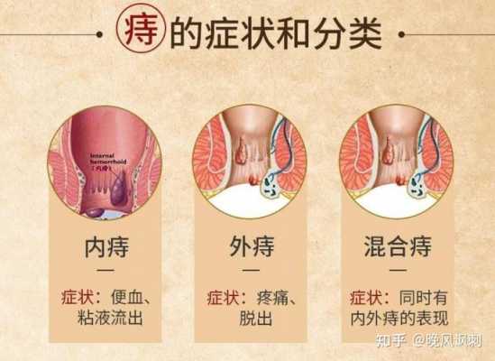 为什么一上火就会痔疮,为什么一上火就会痔疮呢 