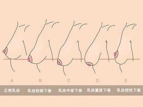 为什么戒奶后乳房变小