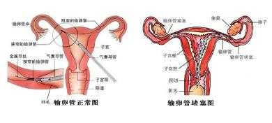 输卵管为什么会打结_输卵管为什么会打结子