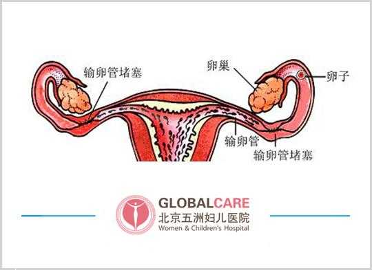 输卵管为什么会打结_输卵管为什么会打结子