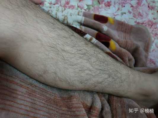 为什么大腿内侧没腿毛